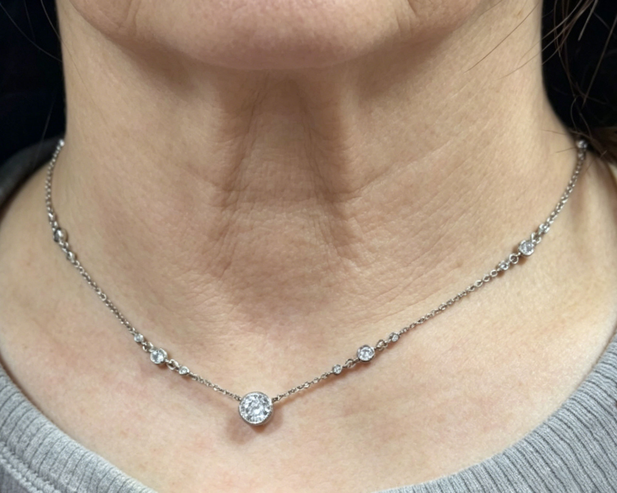 customer review image
